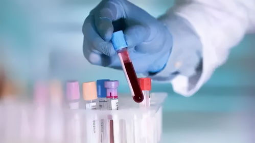 生殖醫(yī)生教您簡單判斷自身卵子質量,如何提高卵子質量