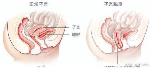 4月官宣三胎5月公布流產,倍速太快被疑是她自導自演