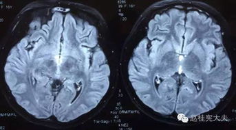 好激烈 你一定沒見過這樣的病例討論