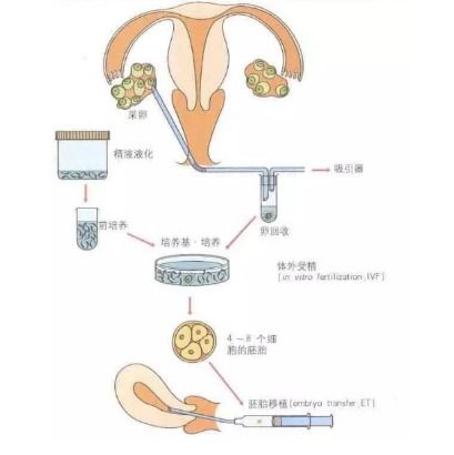 姐姐想知道卵巢早衰的治療方法