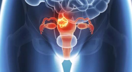 卵巢保養從幾歲開始？喝什么預防早衰？再不行動就晚了！